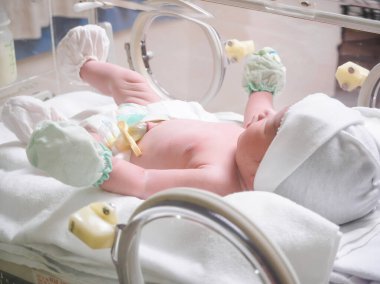 Yeni doğmuş bebek doğum odasındaki kuvözün içinde.