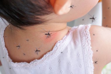 Sivrisinek ısırığından ve kan emmekten boynunda isilik ve alerji olan tatlı Asyalı bir kız bebek.