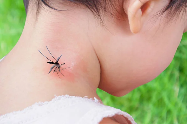 Милая Азиатская Девочка Имеет Сыпь Аллергия Кожу Шеи Укуса Комара — стоковое фото