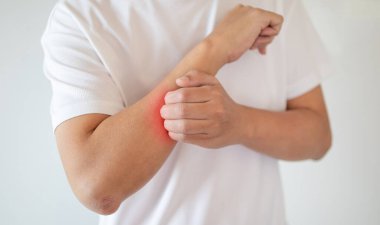 Kaşındıran ve kaşındıran bir adam kaşındıran kuru cilt egzama dermatiti.