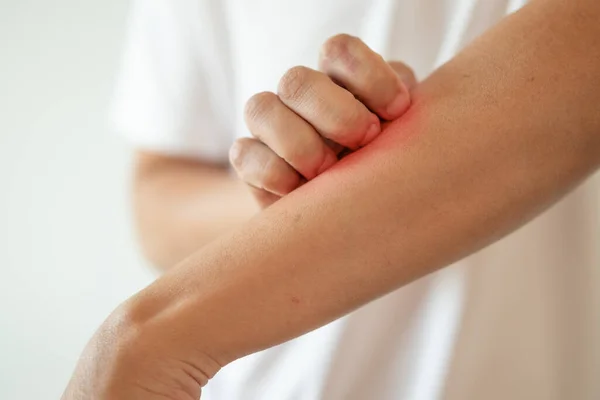 man itching and scratching on arm from itchy dry skin eczema dermatitis