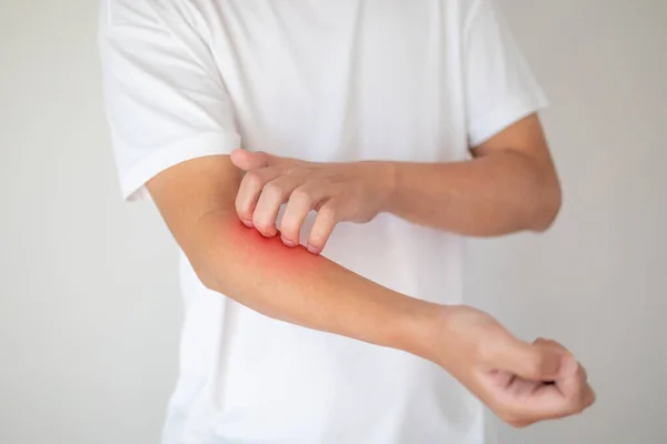 man itching and scratching on arm from itchy dry skin eczema dermatitis