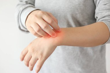 Genç Asyalı kadın kaşındırıyor ve kollarını kaşındırıyor kuru cilt egzama dermatiti yüzünden.