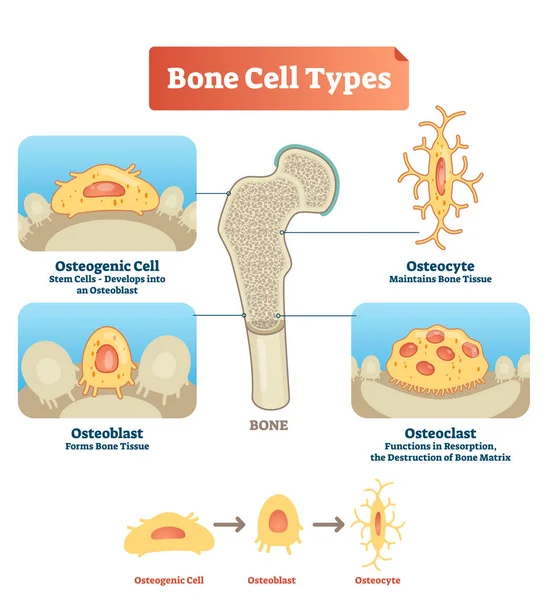 Ilustración vectorial tipo de células óseas diagrama. Esquema de células osteogénicas, osteoblastos, osteocitos. Visualización médica de células madre, tejido óseo y resorción . — Vector de stock