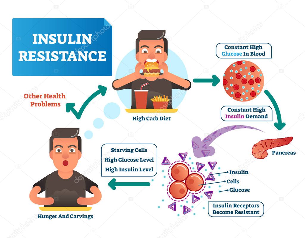 Insulin resistance vector illustration. Labeled scheme with all cycle of process. High glucose in blood, constant demand, pancreas, reporters become resistant and hunger.