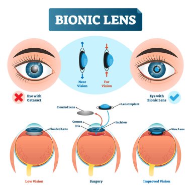 Biyonik objektif vektör çizim. Düzeni etiketli göz lens yapısı.