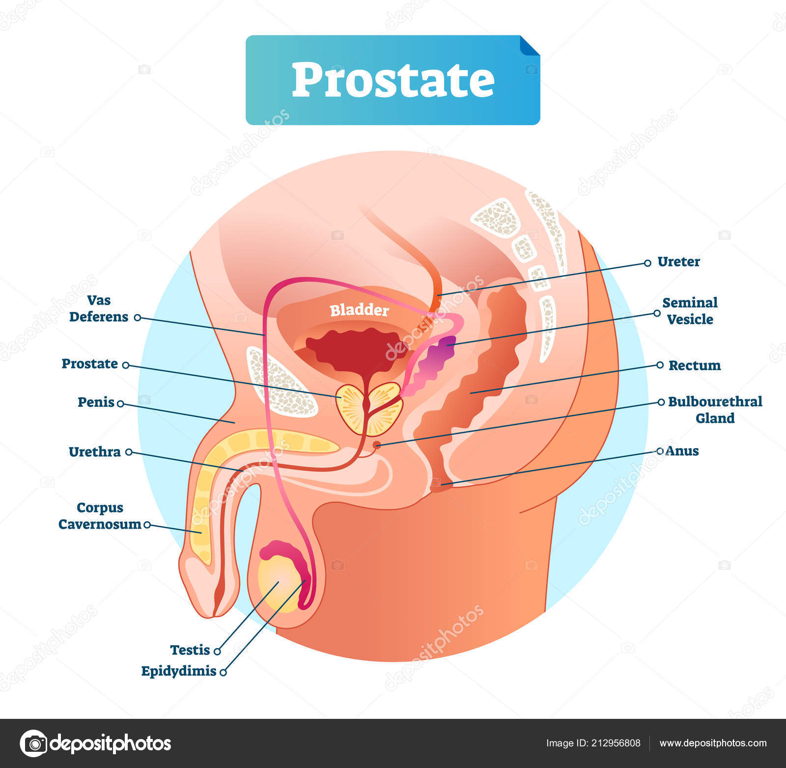 Mi a prostatitis ahogy úgy néz ki. Hogyan néz ki a férfi prosztatagyulladás?