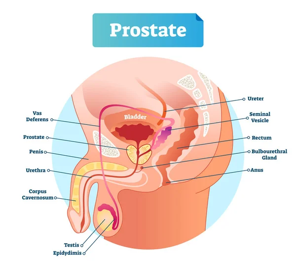 Ilustrasi vektor berlabel Prostat. Skema anatomi pria pendidikan . - Stok Vektor