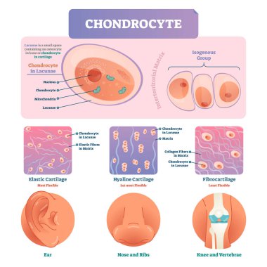 Chondrocyte vector illustration infographic. Medical labeled biology diagram clipart
