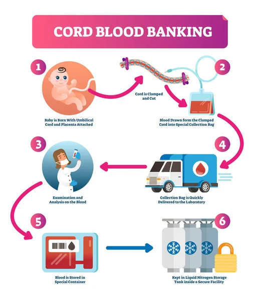 Köldökzsinórvér banki infographic vektoros illusztráció. Magyarázat diagram. — Stock Vector