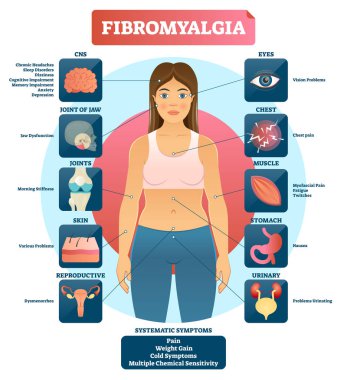 Fibromiyalji vektör çizim. Diyagram etiketli tanı belirtileri.