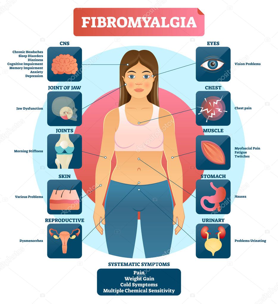 Fibromyalgia vector illustration. Diagnosis symptoms labeled diagram.