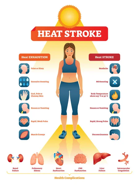 Heat stroke vector illustration. Exhaustion symptoms labeled medical list. — Stock Vector