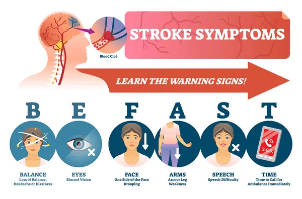 Stroke symptoms vector illustration. Signs of sudden blood clot in head. — Stock Vector