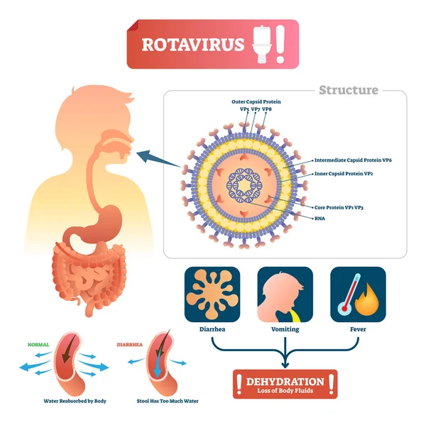Ilustração vetorial de rotavírus. Doença médica do estômago rotulada com sintoma — Vetor de Stock