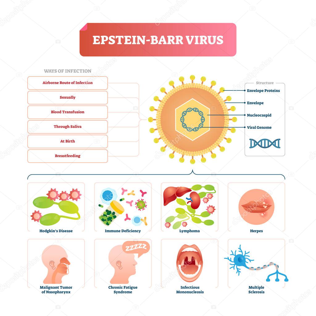 Epstein barr virus vector illustration. Labeled herpes disease explanation.