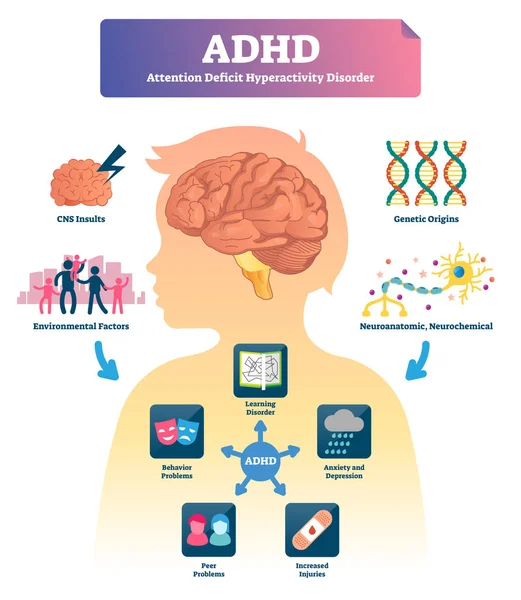 ADHD vektoros illusztráció. Címkézett elme figyelemhiányos zavar rendszer. — Stock Vector