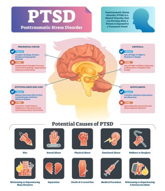 TSSB vektör çizim. Etiketli anatomik ruhsal bozukluk nedenleri düzeni.