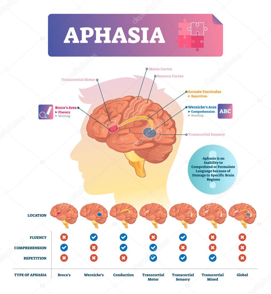 Aphasia vector illustration. Labeled educational scheme with brain disorder