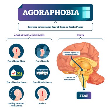 Agoraphobia vector illustration. Labeled anatomical fear explanation scheme clipart