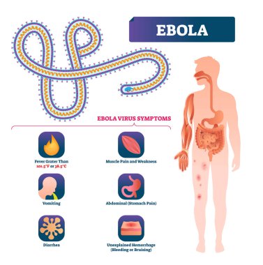 Ebola vektör çizim. Etiketli virüs bakteri enfeksiyonu belirtileri düzeni