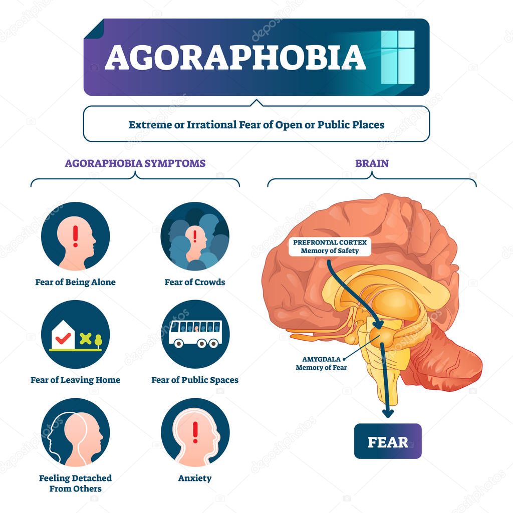 Agoraphobia vector illustration. Labeled anatomical fear explanation scheme