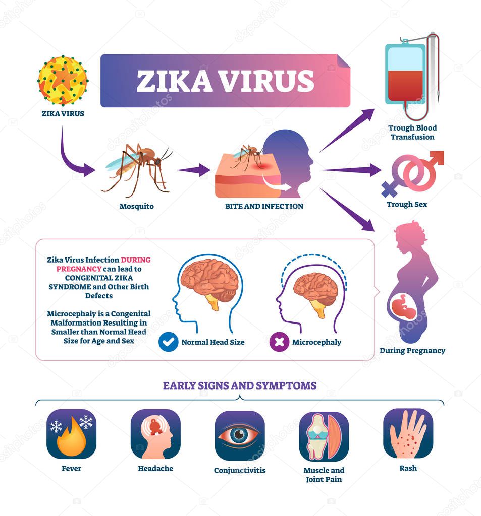 Zika virus vector illustration. Labeled mosquito bite infection sign scheme