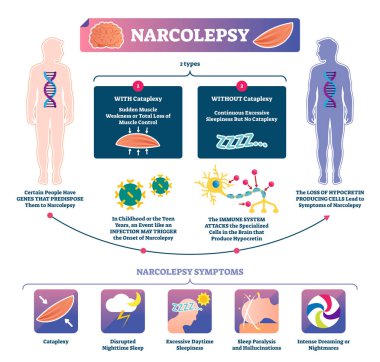 Narkolepsi vektör çizim. Etiketli kas gücü hastalık Infographic
