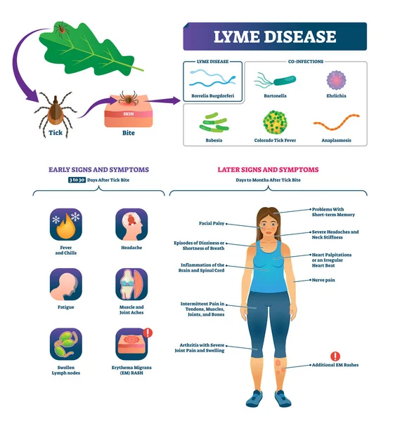 Lyme-kór vektoros illusztráció. Kullancs harap fertőzés tünetei lista feliratú — Stock Vector