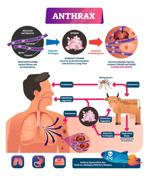 Anthrax vector illustration. Labeled medical infection disease cycle scheme — Stock Vector