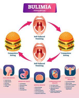 Bulimia vektör Illustration. Etiketli kendinden kaynaklı kusma tanı şeması