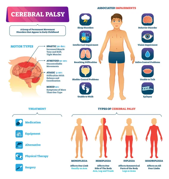 Serebral palsi vektör Illustration. Kalıcı hareket bozukluğu tip şeması — Stok Vektör