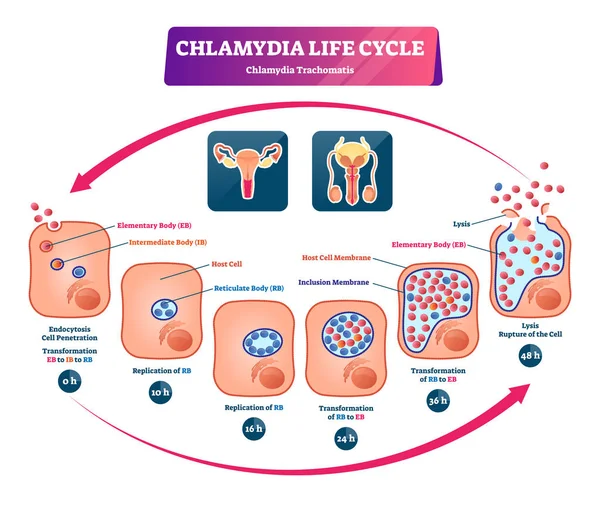 Ilustración del vector del ciclo de vida de la clamidia. Desarrollo de infección por ITS etiquetada — Vector de stock