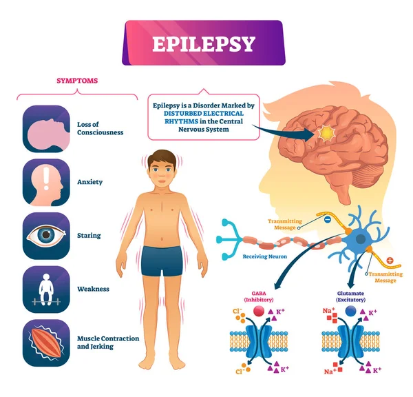 Epilepsi vektor illustration. Märkt Sick CNS sjukdom utbildningssystem. — Stock vektor