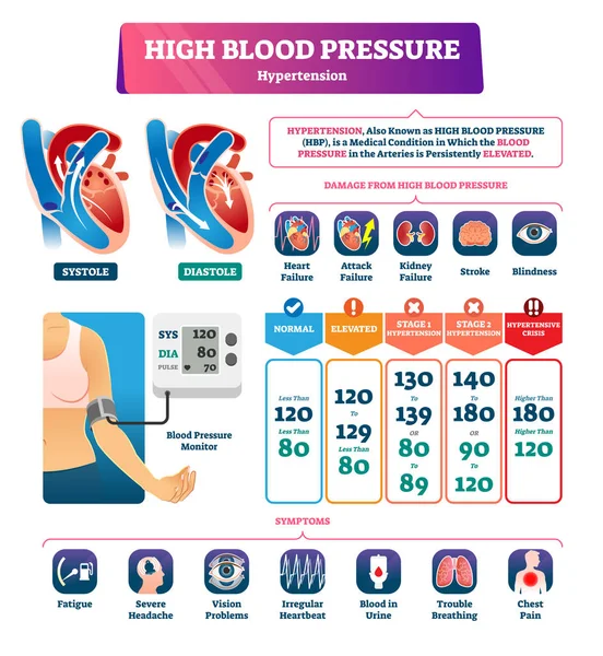 High blood pressure vector illustration. Labeled systole explanation scheme — Stock Vector