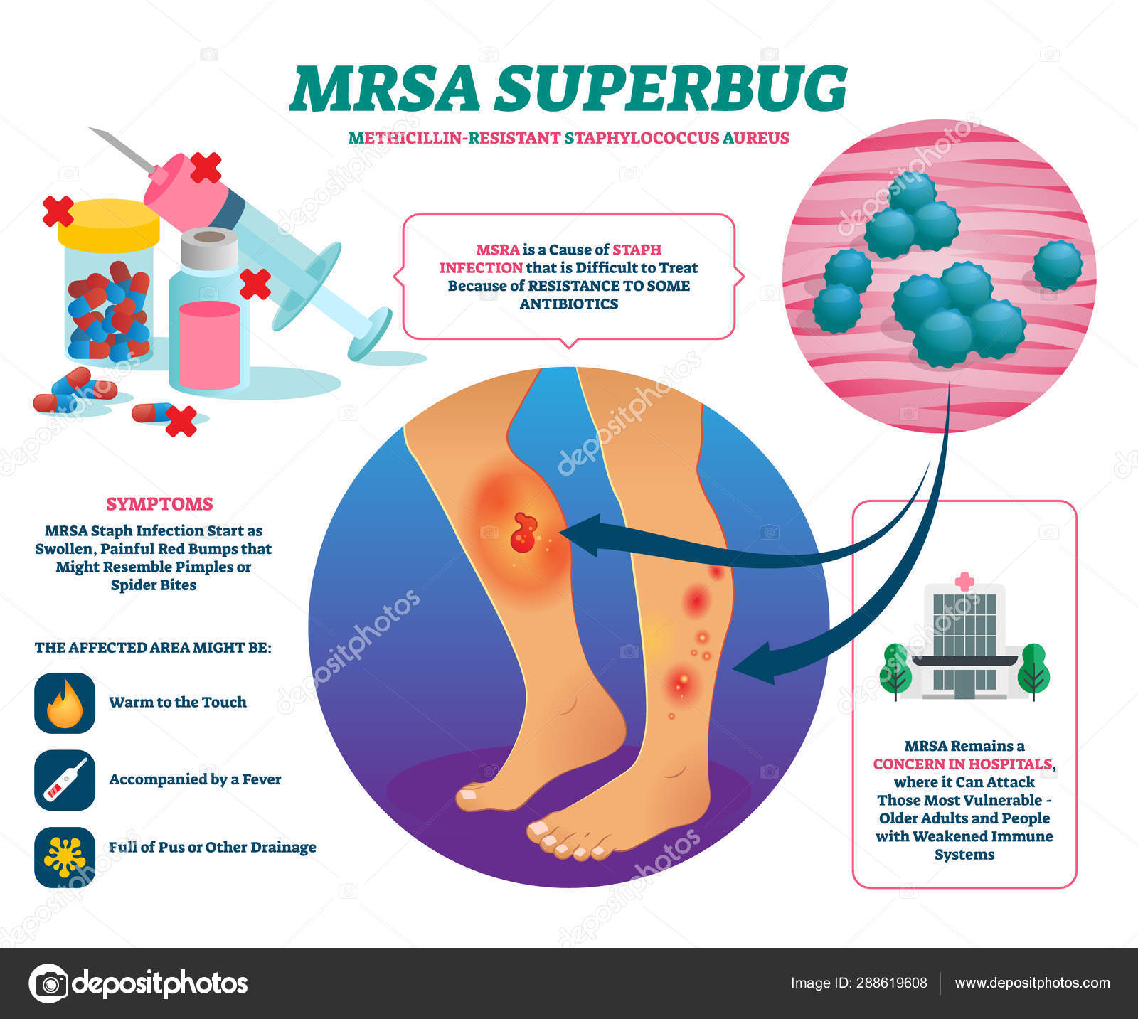 Image vectorielle Illustration vectorielle de super insectes SARM ...