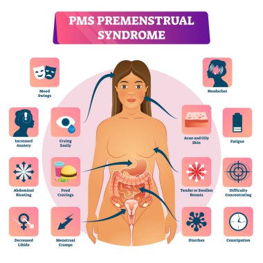 Pms veya Premenstrüel Sendrom vektör illüstrasyon eğitim belirti şeması