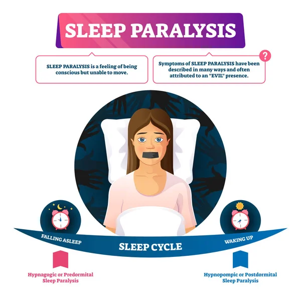 Illustrazione vettoriale della paralisi del sonno. Incapace cosciente movimento sensazione problema — Vettoriale Stock