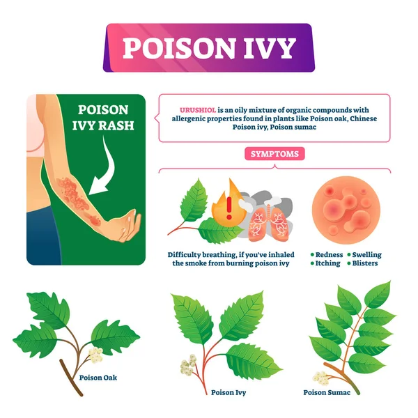 Poison ivy vector illustration. Educational dangerous urushoil plant scheme — Stock Vector