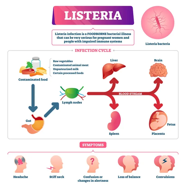 Listeria vector illustratie. Gelabeld educatief door voedsel overgedragen bacteriën schema — Stockvector