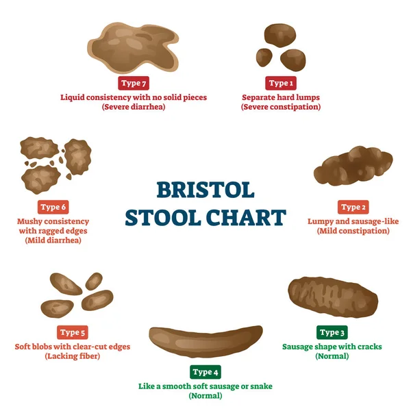 Bristol pall diagram verktyg för avföring typ klassificering vektor illustration — Stock vektor