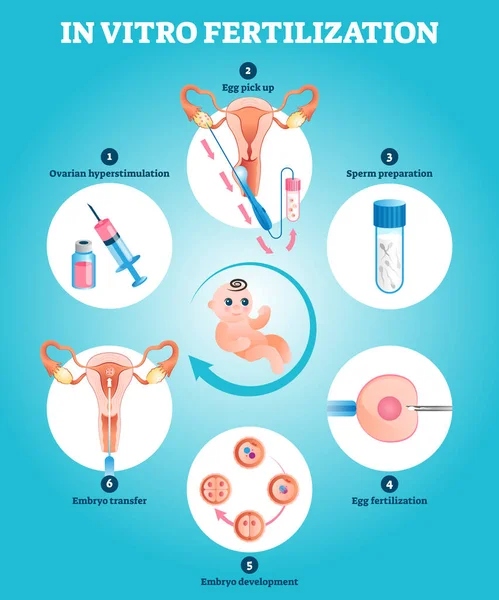 In Vitro γονιμοποίηση τεχνητή αναπαραγωγή εγκυμοσύνη διανυσματική απεικόνιση — Διανυσματικό Αρχείο
