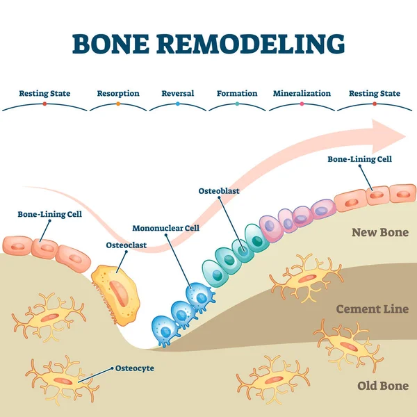 Spiegazione educativa del processo di rimodellamento osseo con schema di struttura etichettato — Vettoriale Stock