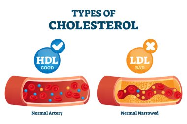 Kolesterol türleri HDL ve LDL lipoprotein vektör çizimi ile karşılaştırıldığında