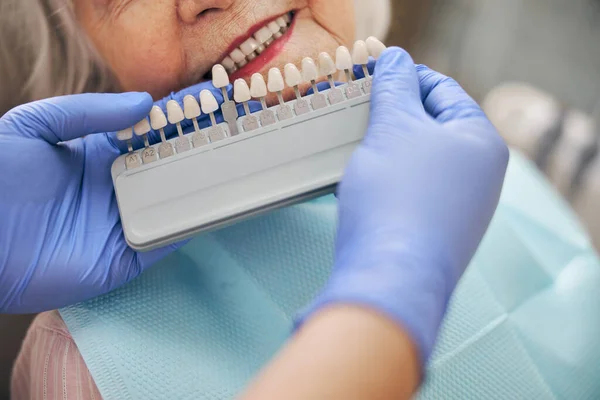Lekarz sprawdzający i wybierający kolor zębów w fotelu dentystycznym — Zdjęcie stockowe
