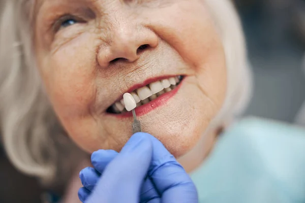 Elderly woman choosing color of teeth while sitting in the dentist chair — Stock Photo, Image