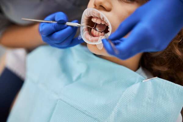 Ребенок с плотиной во рту