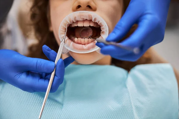 Kind gaat door een tandheelkundige ingreep met een rubberen dam — Stockfoto