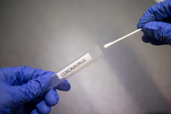 Coronavirus Analysis Using Swab Laboratory Scientist Gloves Covid Pandemic — Stock Photo, Image