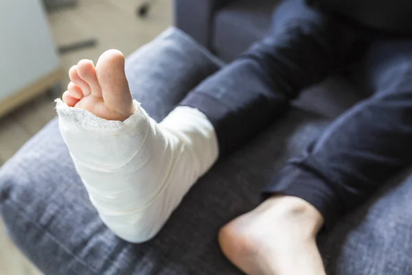 Złamaną nogą na poduszce w czasie rekonwalescencji — Zdjęcie stockowe
